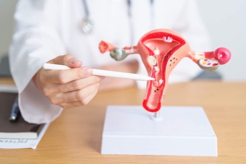 O que é endometriose